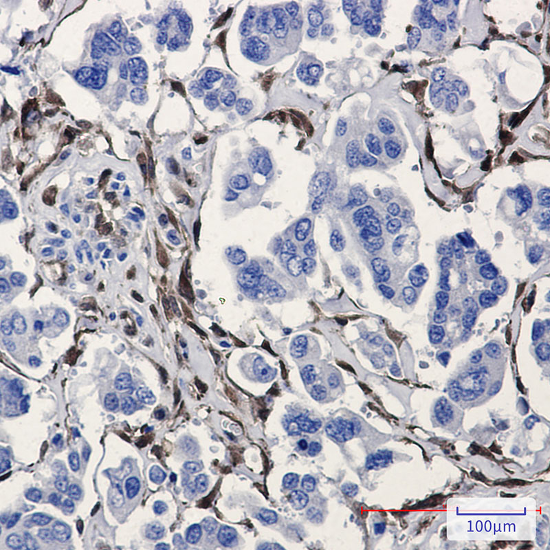 IHC - ALDH1A1 Rabbit mAb AP74894
